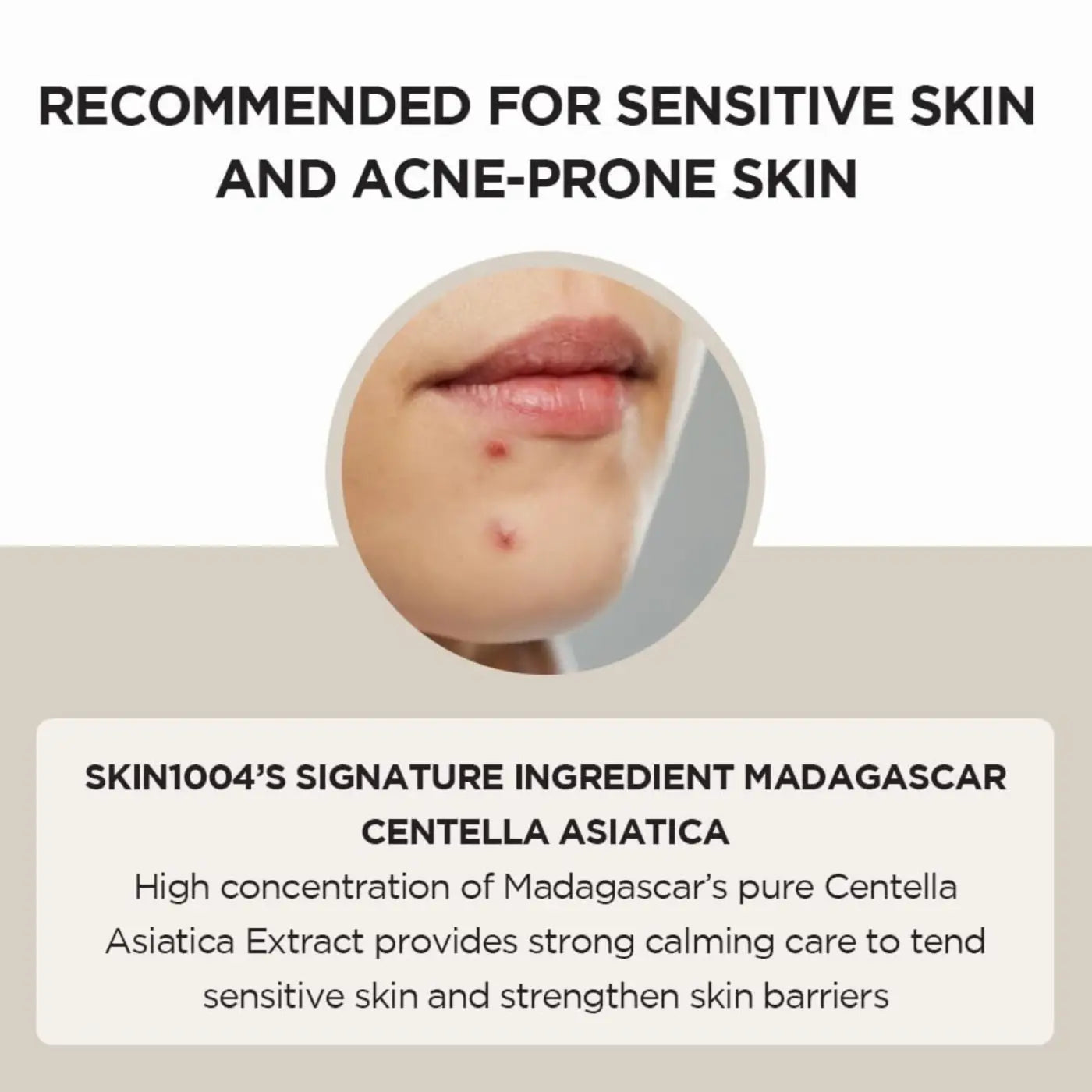 A close-up of a person with red blemishes showing the need for madagascar centella ampoule with centella asiatica extract