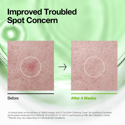 Azelaic Acid 3 Cica Skin Clarifying Toner