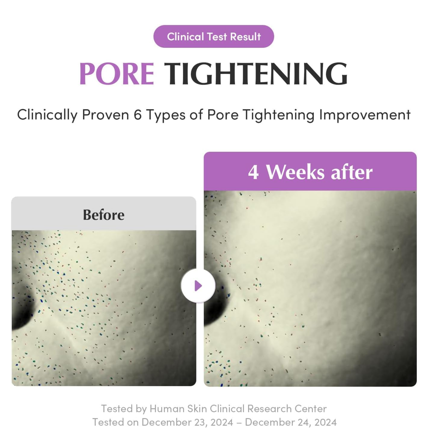 Purple PDRN Pore Minimizing Serum 30ml - Serum and Ampoule