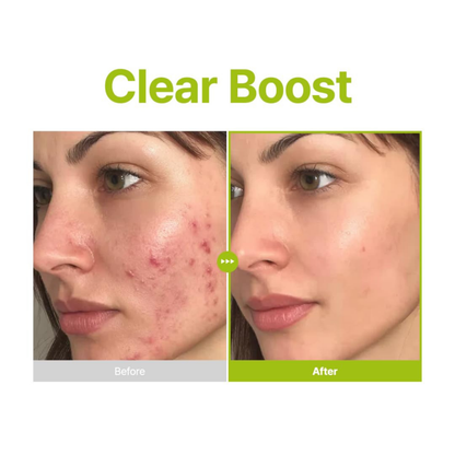 Azelaic Acid 10 Kojic Tea Tree Serum - Serum and Ampoule