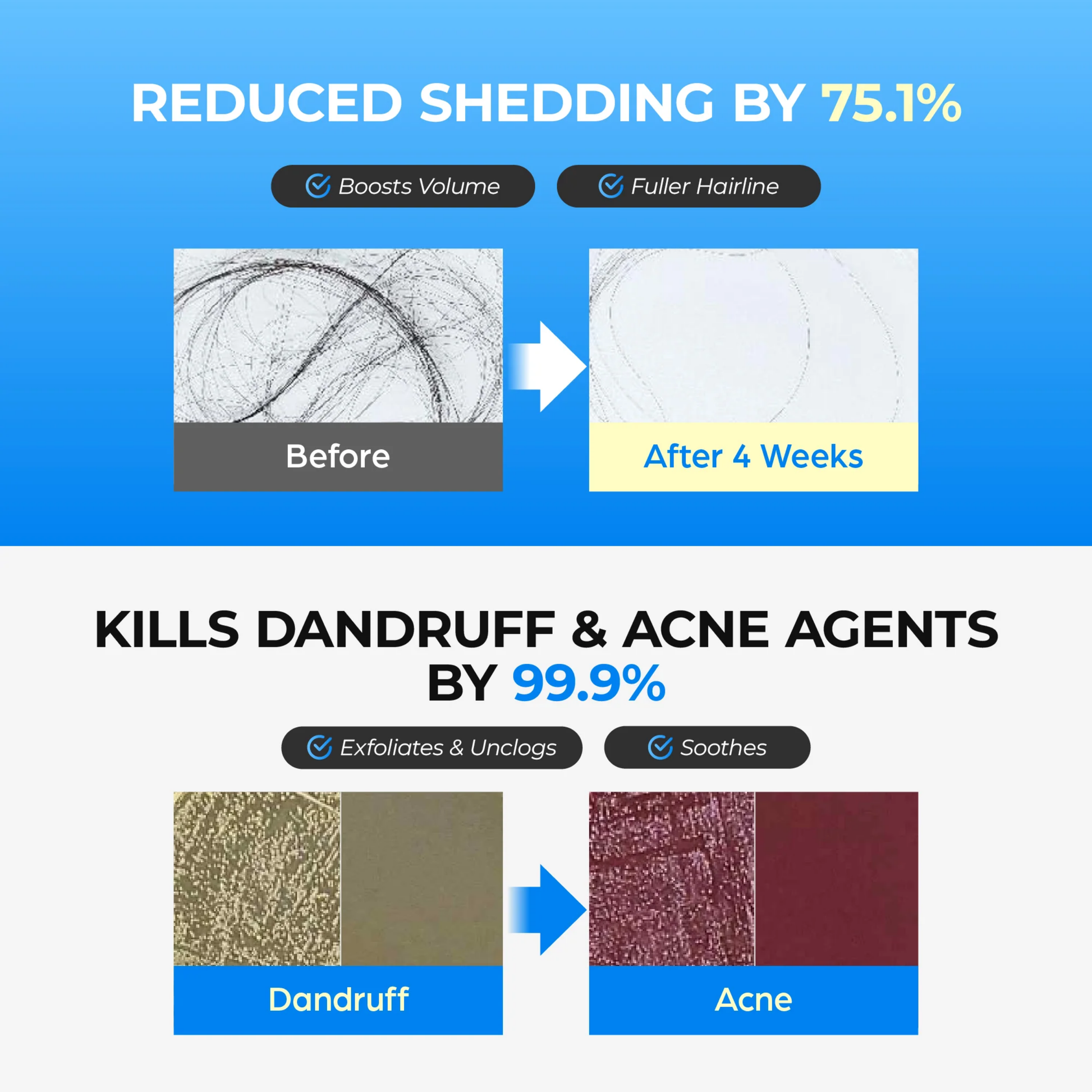 Scalpy Bubble Tonic - Hair Care