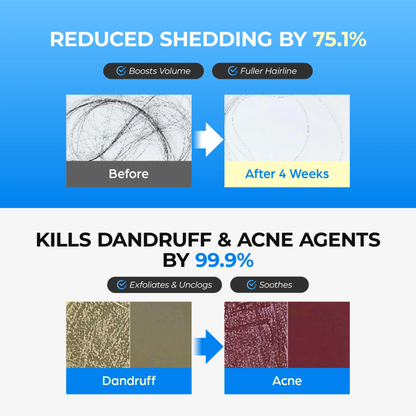 Scalpy Bubble Tonic - Hair Care