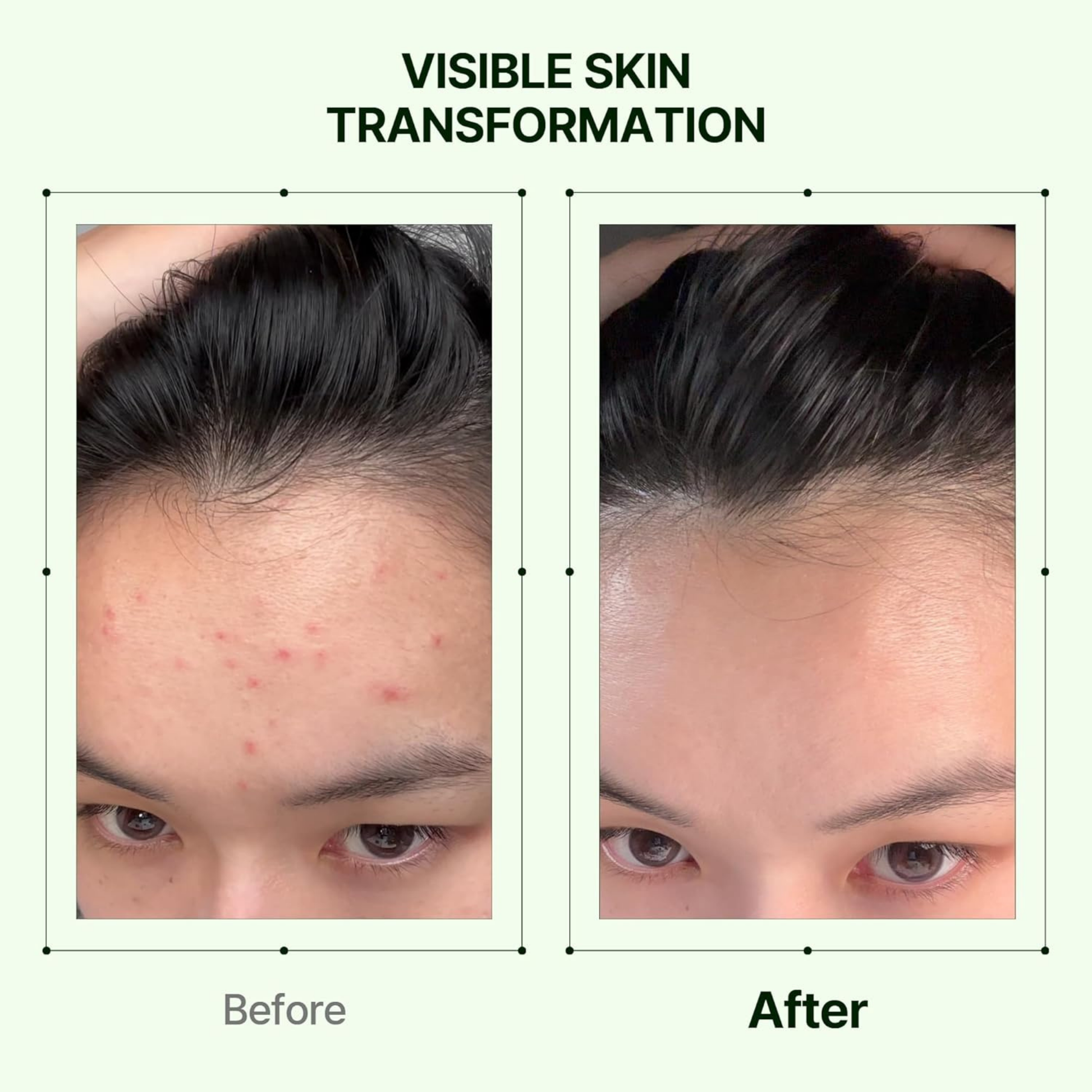 Mugwort Soothe In Toner - Toner and Toner Pad