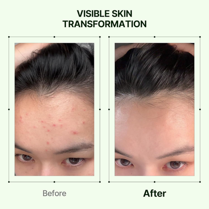 Mugwort Soothe In Toner - Toner and Toner Pad