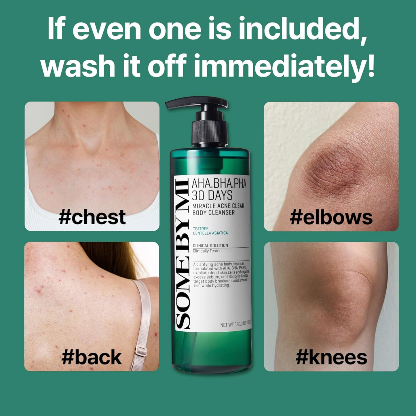 AHA BHA PHA 30 Days Miracle Acne Clear Body Cleanser - Body Care