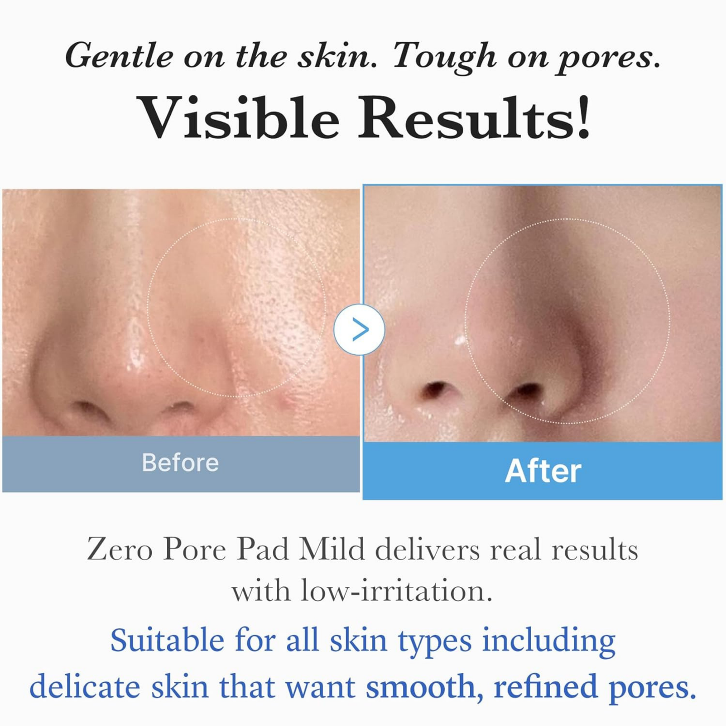 Zero Pore Pad Mild - Toner and Toner Pad