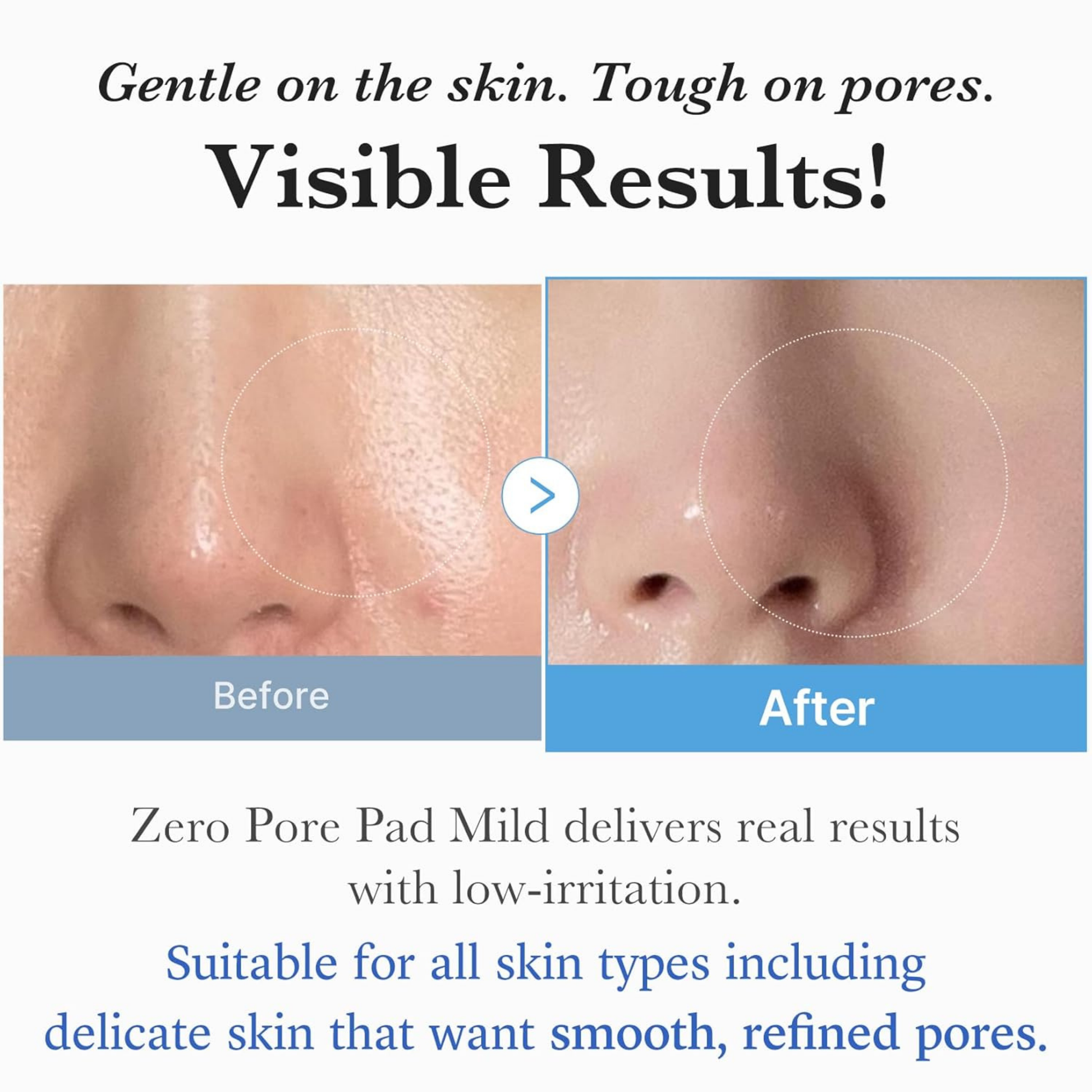 Zero Pore Pad Mild - Toner and Toner Pad