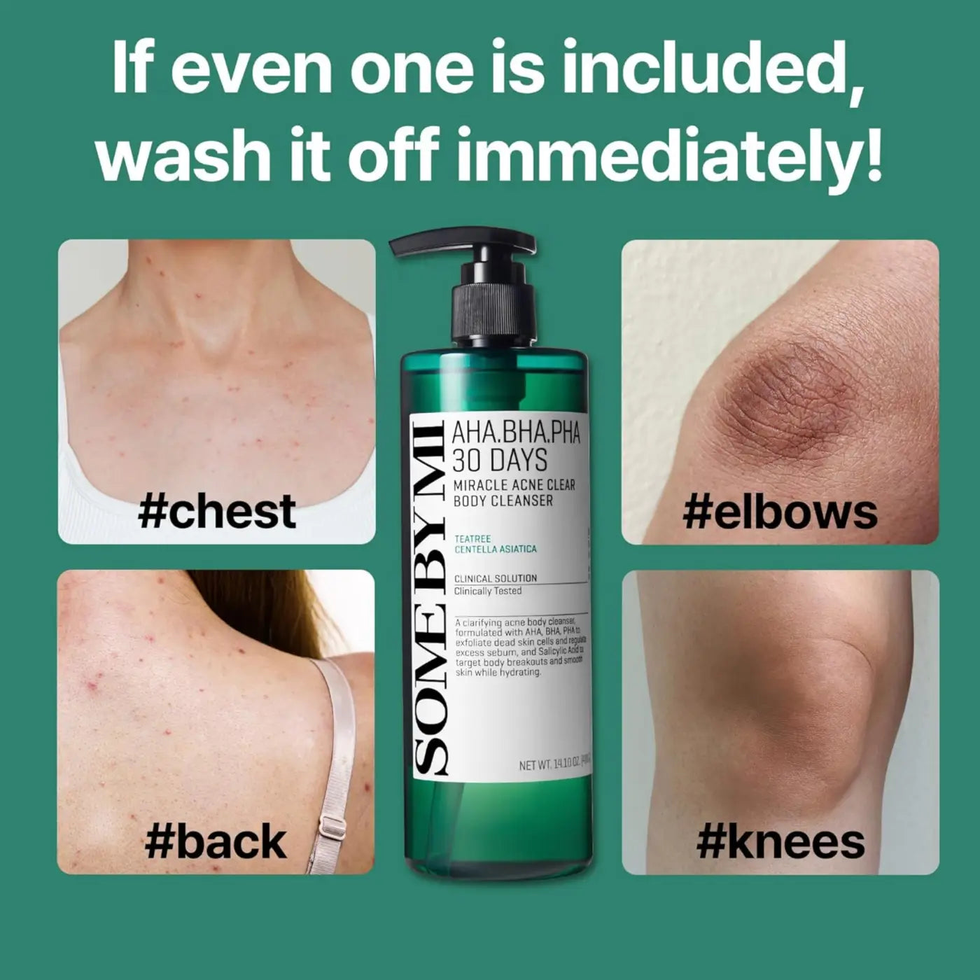 A green glass bottle with black pump labeled some by mi aha bha pha 30 days miracle acne body cleanser