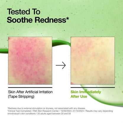 A green-tinted azelaic acid serum for blemish-prone skin showing before and after results in korean skincare ad