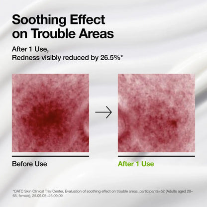 Azelaic acid cica skin soothing moisturizer visibly reduces redness in trouble areas after one use with before and after