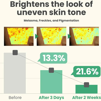 Before and after infographic of dark spot correcting glow serum showing improved melasma pigmentation and moisture barrier