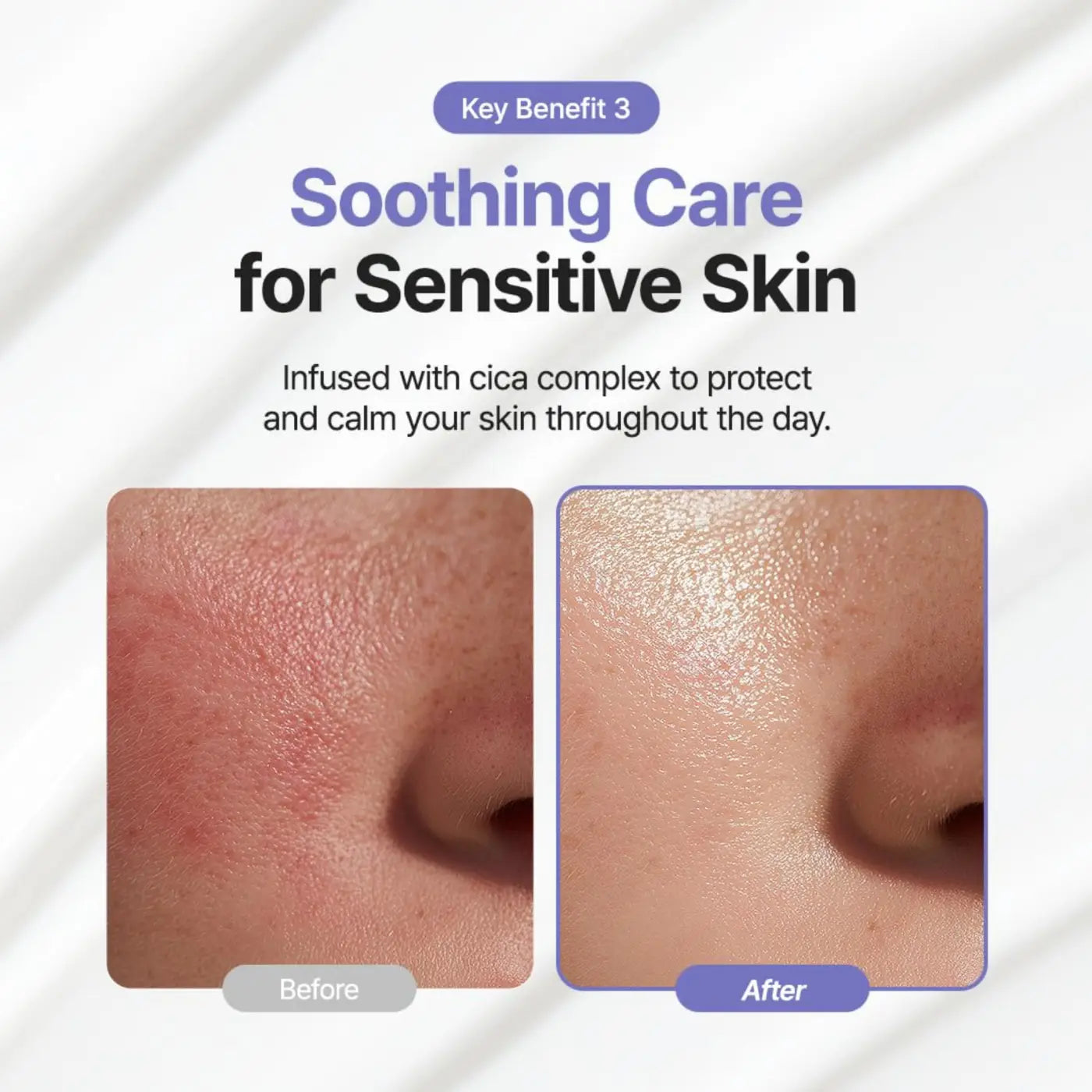Before and after of irritated and calmed skin using luminous ceramide moisturizer with cica complex for sensitive skin
